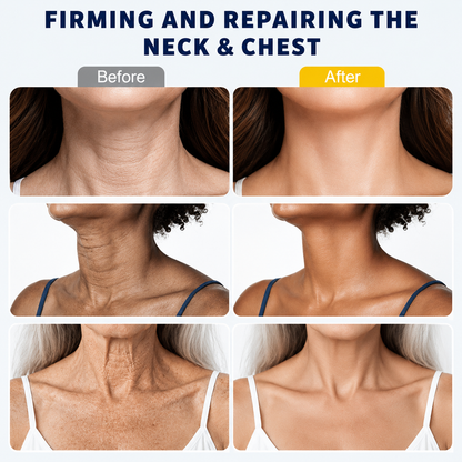 Instant Neck Lift Cream
