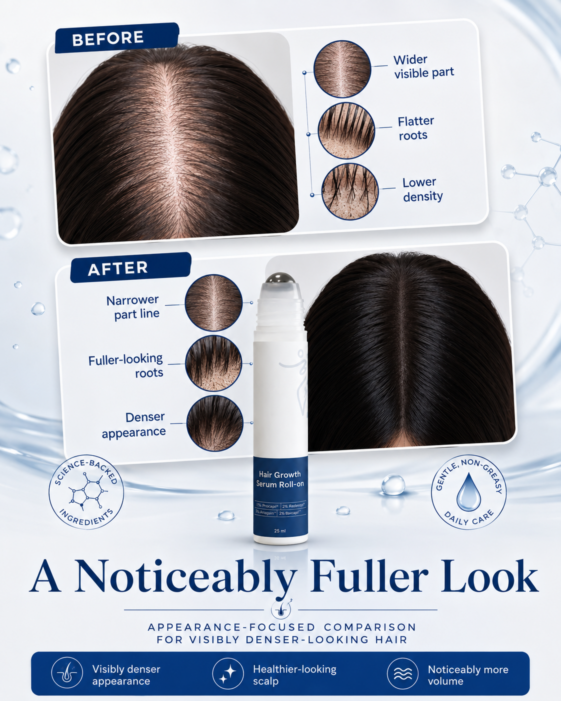 Advanced Hair Density Roll-On Scalp Serum – Saw Palmetto, Rosemary & Caffeine for Fuller-Looking Hair