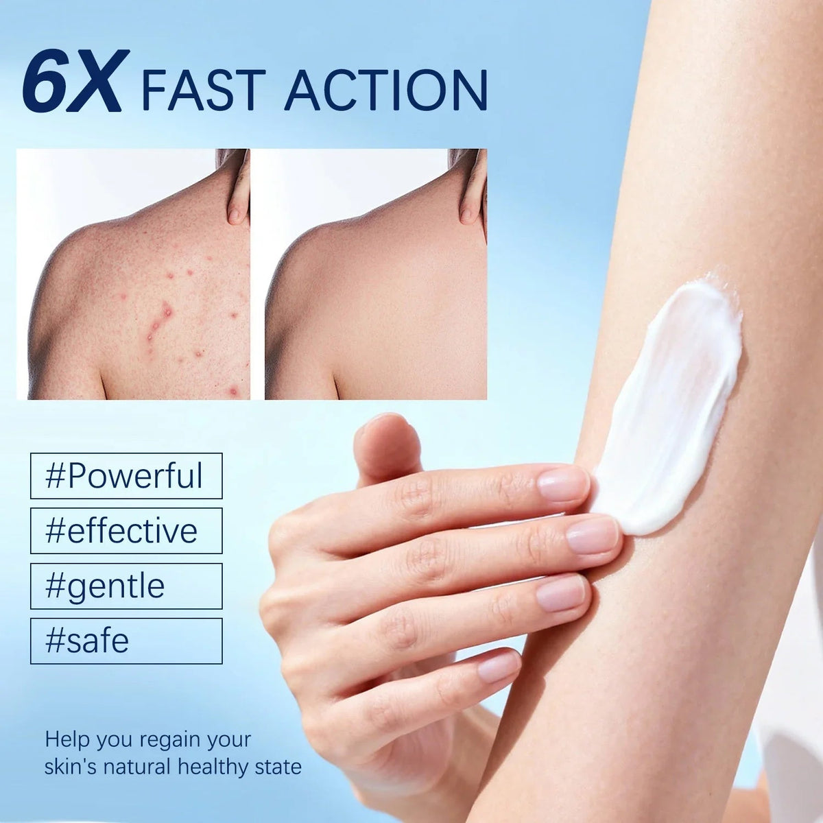 💙Folliculitis Soothing Cream for Folliculitis Scalp Face and Body💙